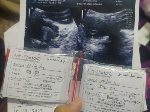 Letak nya D bawah apa emang belum keliatan aja?