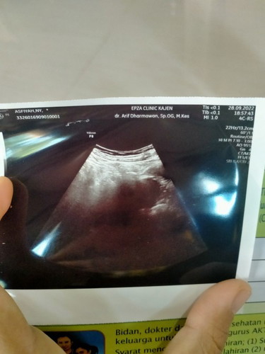 Usia kehamilan 7 mgu 5hari