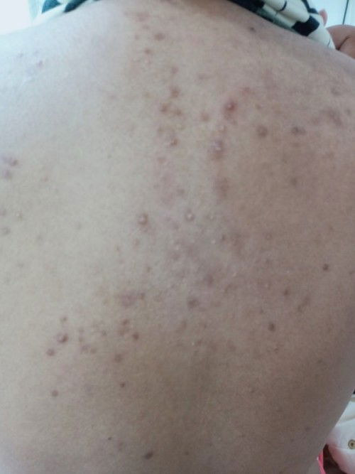 หมดสภาพ 😥