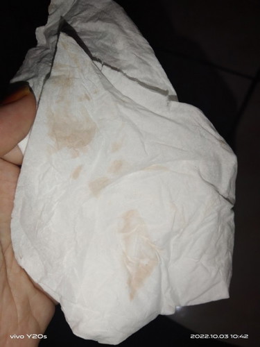 Ada yg pernah ngalamin flek diusia 12w segini Bun?ketambah perut kerasa kram tp masih bisa gerak²