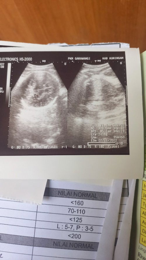 Alhamdulillah bbj naik