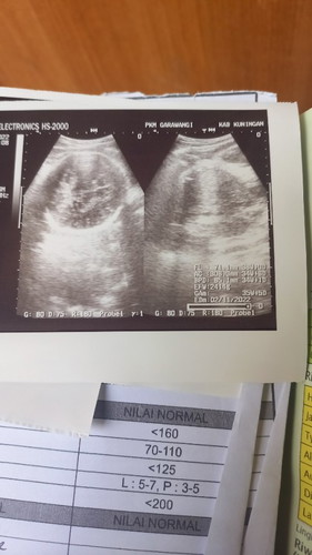 Alhamdulillah bbj naik