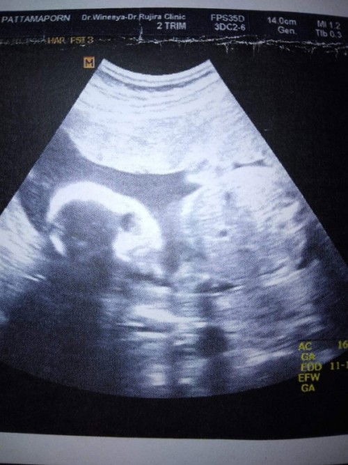 ตั้งชื่อเล่นลูกสาว