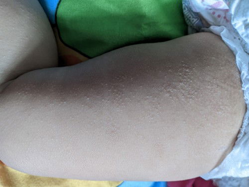 Bintik  bintik kecil