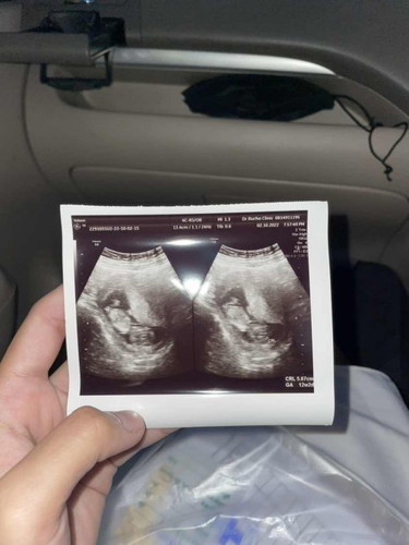 ท้อง12สัปดาห์2วัน