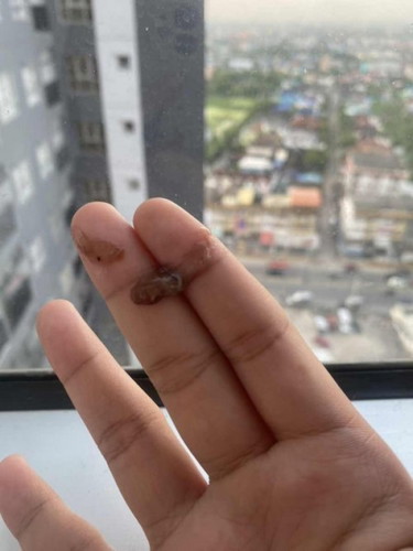 อยากสอบถามแม่ๆหน่อยค่ะพอดีมีมูกแบบนี้ออกมา