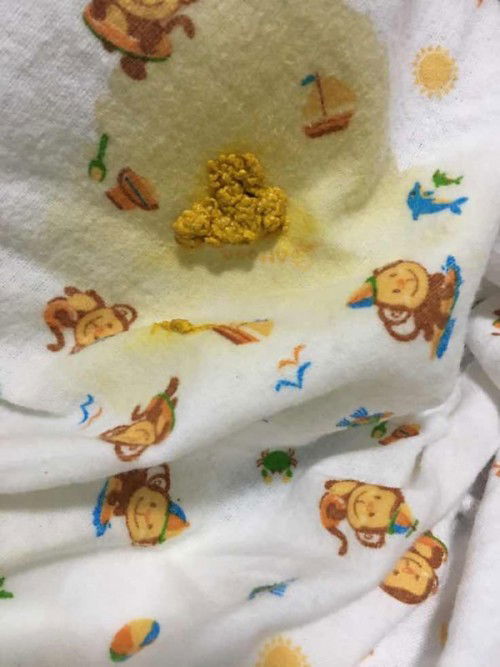 อึแบบนี้ปกติมั้ย