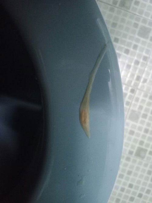 ผ่าคลอดได้1เดือน