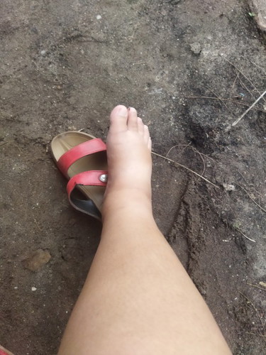 เท้าบวมหนักทำไงดี