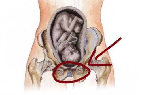 Nyeri dibahagian bawah perut