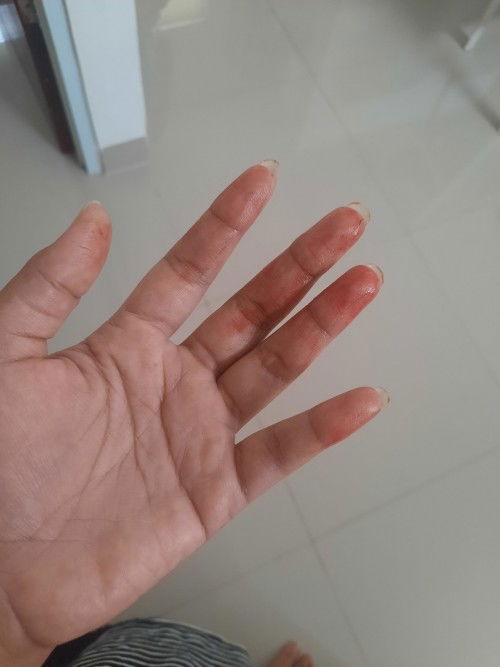 Usia 7w keluar darah merah saat bangun tidur