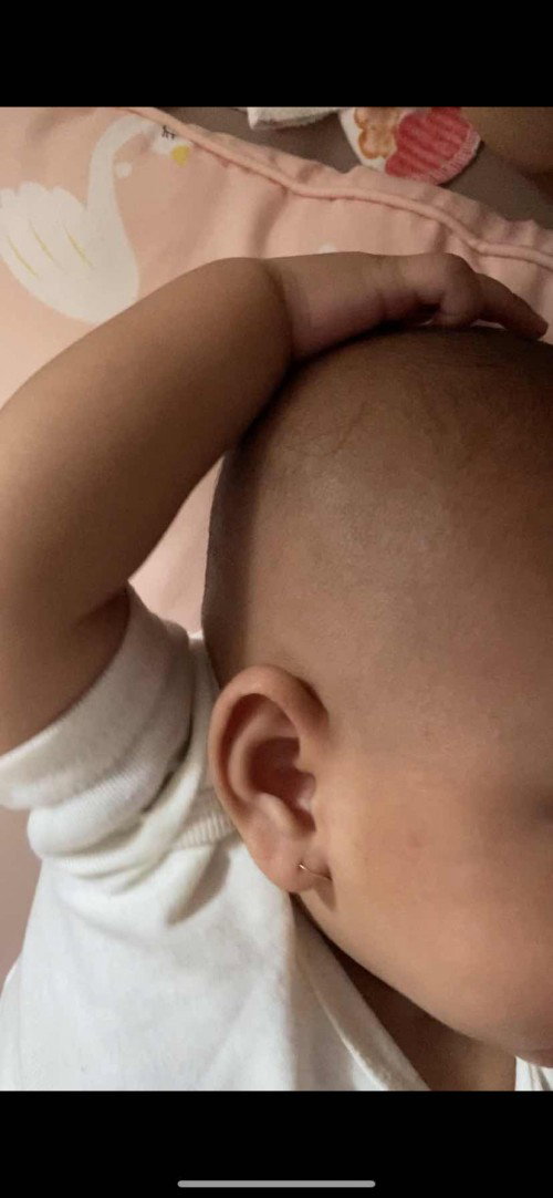 bayi pegang kepala