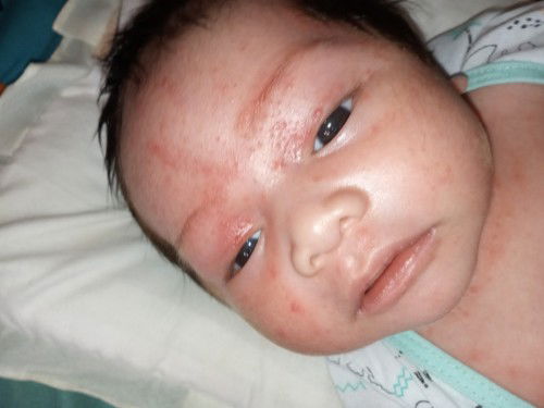 Paano poba matanggal eto?