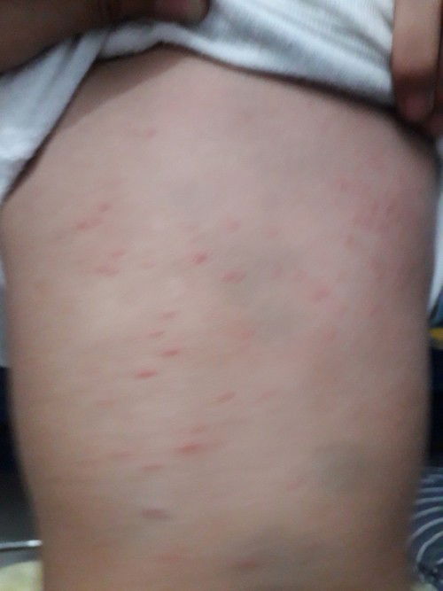 Biang keringet atau apa ya