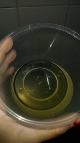 Air kencing ada lendir putih, adakah tanda awal kehamilan?