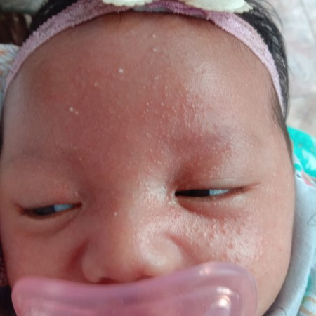 Bunda ada yang sama tidak ya babynya seperti ini mukkany bintik² merah, mhon solusinya donk bun