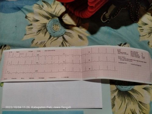 Hasil rekam jantung