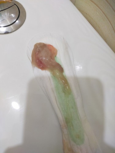 Tanong ko lang po kung mucus plug po ba ito? Medjo kinakabahan po kasi ako 39 weeks napo Salamat po