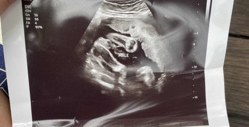 ลูกชายทีมมกราคม66