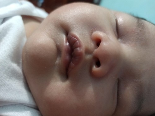 ask ko lang po kung normal po ang ganitong kulay