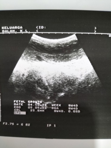 Semalam saya scan 2 klinik, klinik pertama scan ada, klinik kedua scan takde.sedih saya