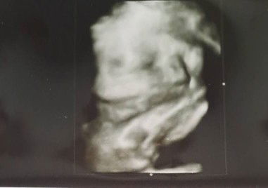 ครรภ์30+6ช่วยแชร์ประสบการณ์หน่อยคะ #ทีมธันวา#ทีมลูกสาว#ทีมคลอดธรรมชาติ#ท้องที่2