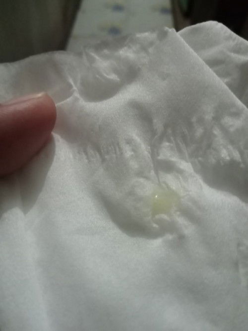 38+1 นี่คือมูกมั้ยคะเป็นก้อนยืดมากค่ะปกติตกขาวไม่เป็นเเบบนี้