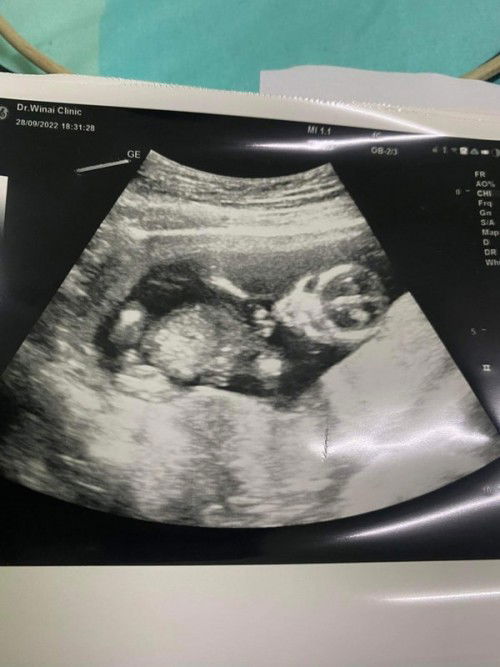 สอบถามแม่ๆหน่อยคะ