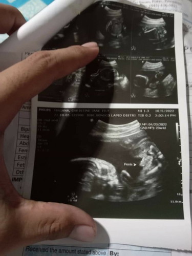 hi mga mommies ask ko lang po if?