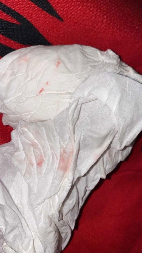 Keluar cairan lendir darah sedikit 37week