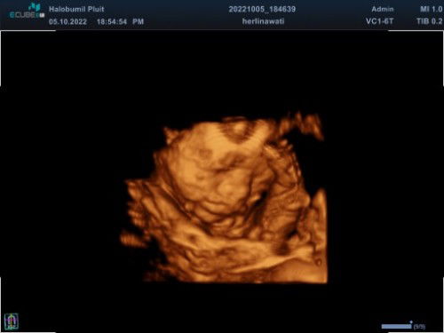 hasil USG 4D usia 29w