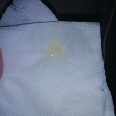 Mucus plug poba ito?