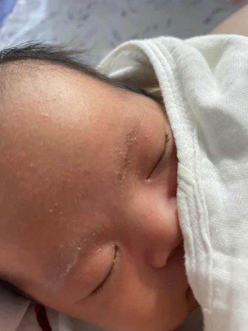 อันนี้คือน้องเป็นอะไรคะ