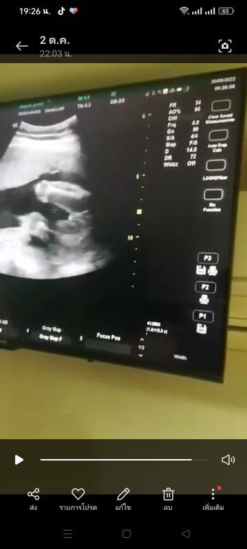 แม่ๆคิดว่า ญ/ช คะ