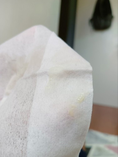 Ano po ba tong discharge na ito?