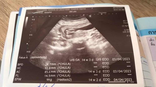 กังวลลูกตัวเล็ก