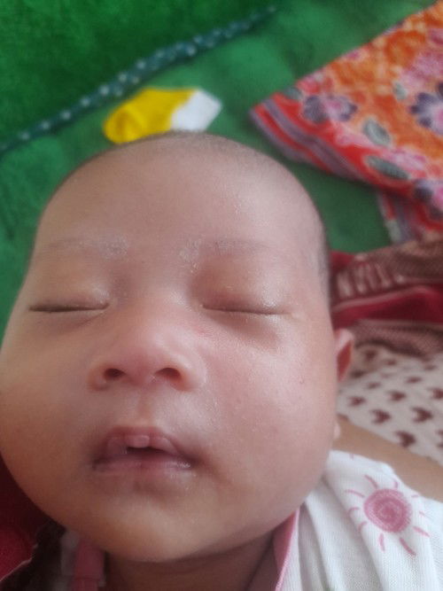 Kenapa ya bun muka anak saya bintik merah2, oh iya bun obat pilek untuk bayi 28 haari apa ya bun