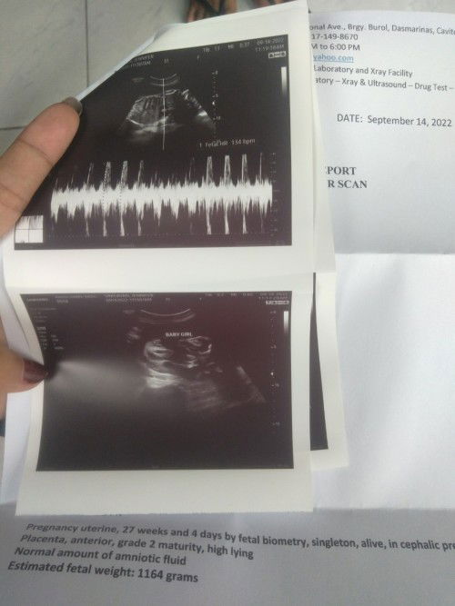 Mga momshie ang due date ko sa ultrasound is end of November po masusunod po kayo yan or advance ?