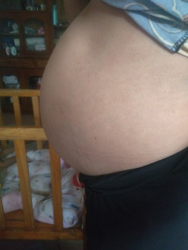 32 weeks and 2 days mababa napo ba araw araw nman ako naglalakad at d namanas ung paa ko