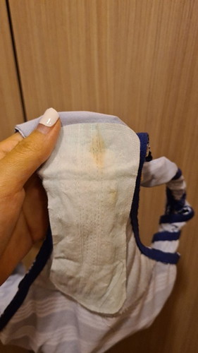 Sorry for the gross photo but I needed help badly.