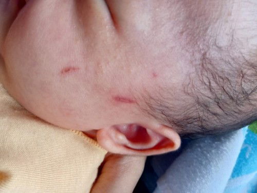 mencakar wajahnya sendiri