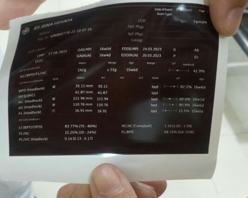 Bantu baca hasil usg.