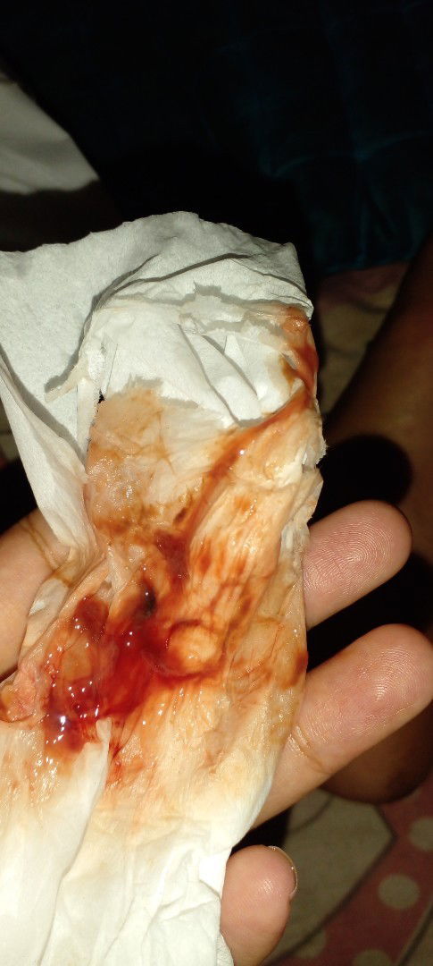 Apakah tanda persalinan