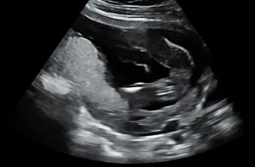 PINJAM MATA IBU IBU DILUAR 🥺