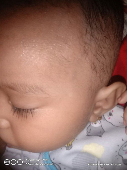 Flu dan batuk pada bayi 6 bulan