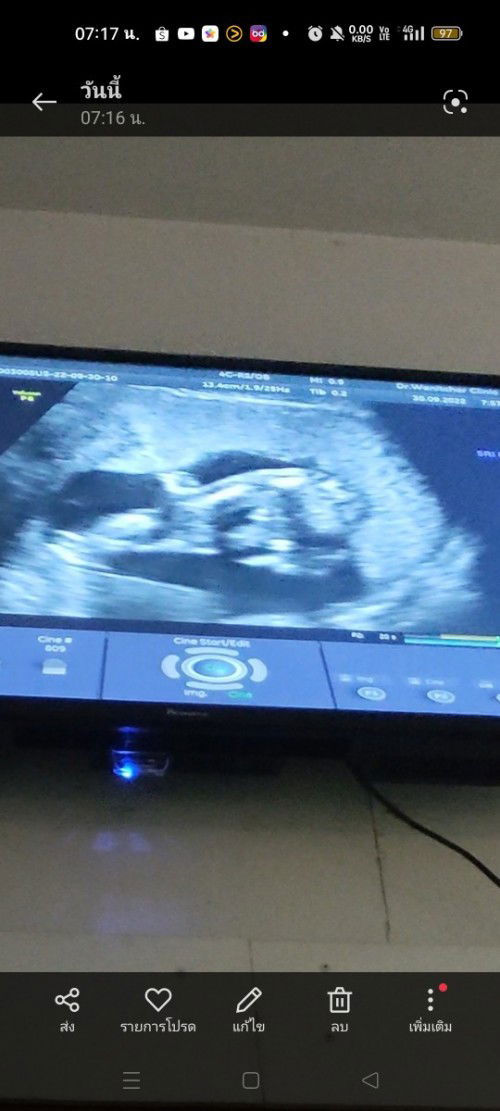 แม่ๆว่าหญิงหรือชายค่ะ