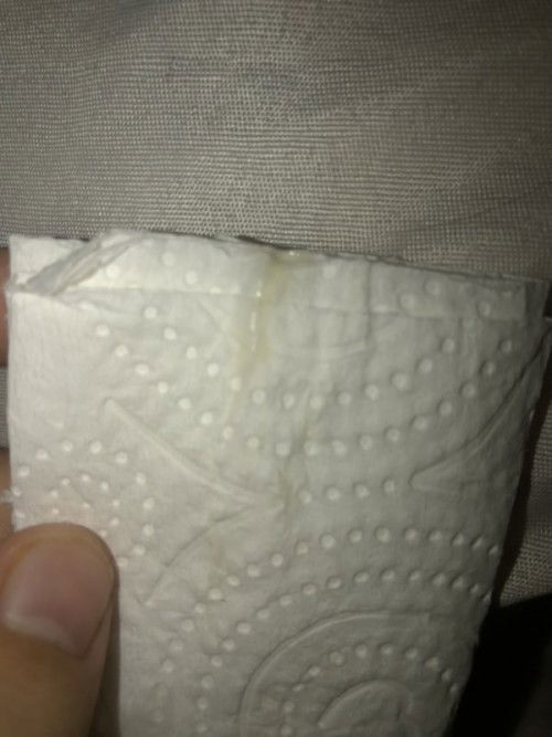 ใครเป็นเหมือนกันมั้ยคะ