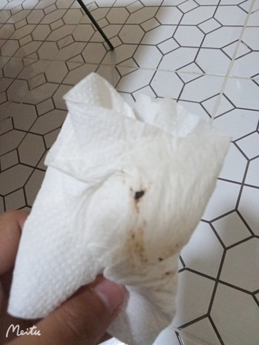 ก้อนเลือดสีดำ