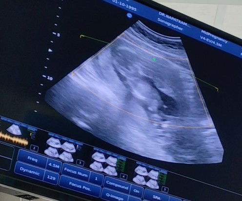 แม่ๆ ช่วยดูหน่อยค้าาา น้องน่าจะเป็นผู้หญิง หรือ ผู้ชายคะ น้องได้ 14 สัปดาห์ค่ะ แม่ๆดูออกมััยคะ