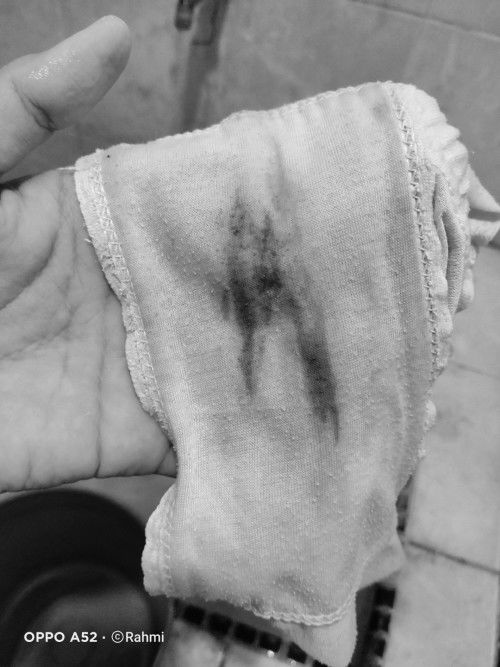 Keluar flek dikehamilan 7minggu